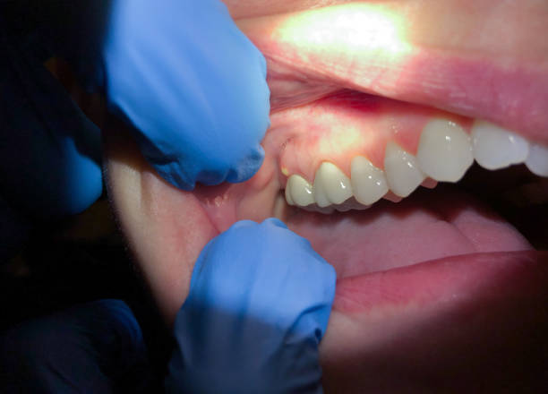 Best Emergency TMJ Treatment in Ship Bottom, NJ